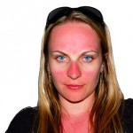 Coup de soleil