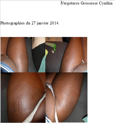 Vergetures Janvier 2014