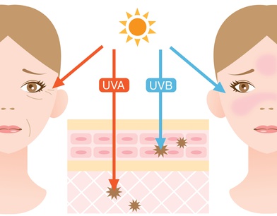 Action des UVa et UVB sur la peau