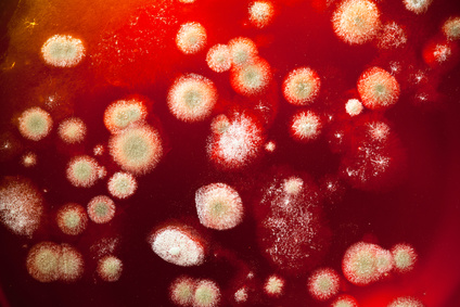 Culture de Levures Malassezia Furfur dans le Pityriasis Versicolor sur fond rouge