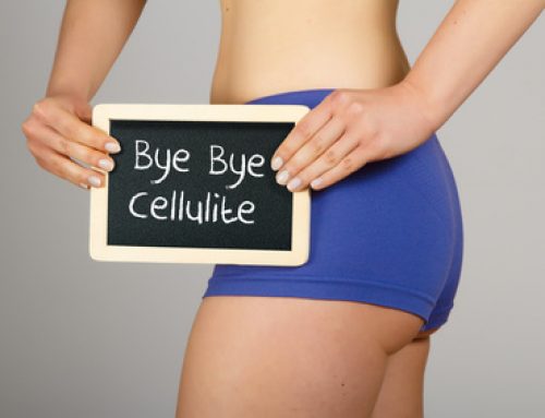 Enlever la cellulite : sur quels facteurs agir pour lutter efficacement ?