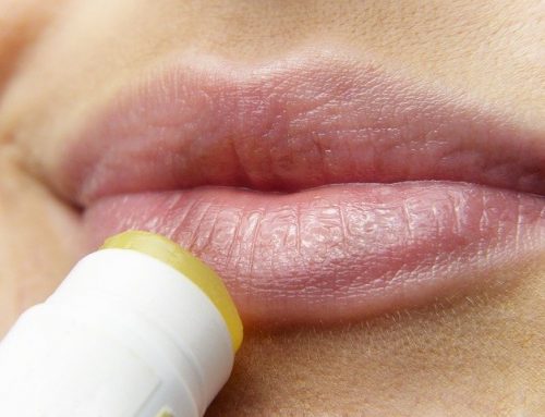 Lèvres abîmées, bouton de fièvre : existe t’il une Solution Naturelle ?