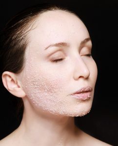 exfoliation