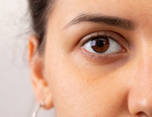 Cernes, poches sous les yeux : quelles sont les causes et pourquoi en a t’on ?