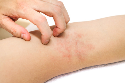 Que Faire Si Vous Faites Une Reaction Cutanee A Un Produit Cosmetique Oleassence En Luberon