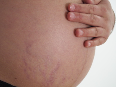 Barriga embarazo